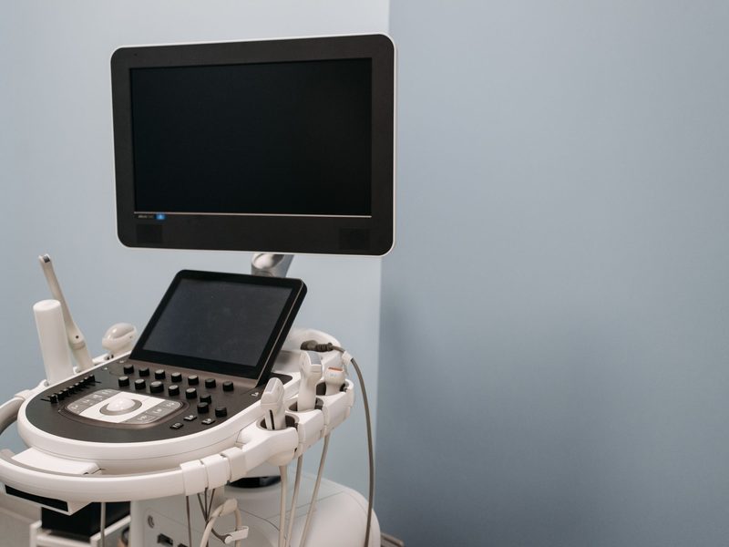 Ultrasound scanner on a mobile trolley in a clinic room, its screen and control panel raised above a rack of probes